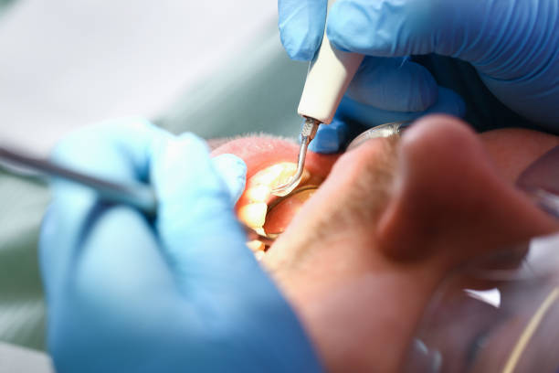 Best Emergency Tooth Extraction in Thomasville, AL